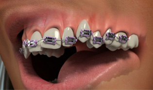 Orthodontics